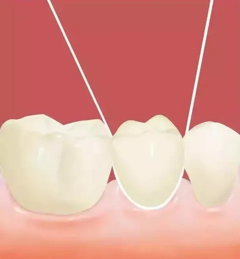 使用牙线好吗？牙线什么时候使用最好？