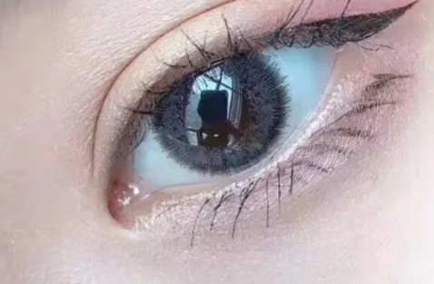 非离子美瞳和硅水凝胶哪个好？美瞳要泡多久才能戴？