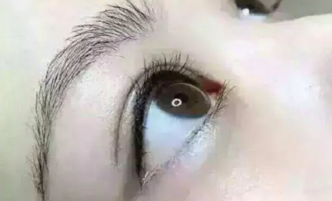戴美瞳眼睛红正常吗？佩戴美瞳注意事项？