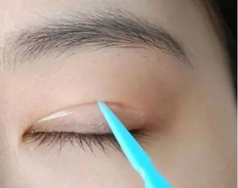 双眼皮贴和双眼皮胶水有何不同？哪种效果最好？